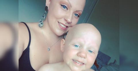 Tras 7 años ocultando su calvicie renuncia a las pelucas para animar a su hija de 2 años sin cabello