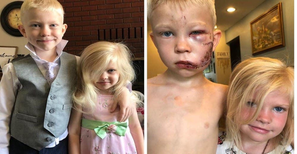«Si alguien iba a morir, pensé que debería ser yo» – A los 6 años salva la vida de su hermanita «Si alguien iba a morir, pensé que debería ser yo» – A los 6 años salva la vida de su hermanita