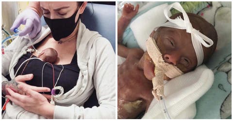 La madre de la bebé más prematura del mundo que lucha por vivir pide ayuda