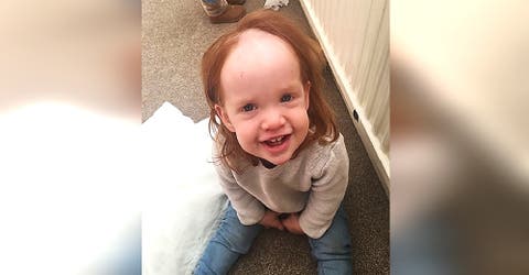Cuando la madre de esta bebé vio su cabello rompió en llanto y se enojó con su esposo