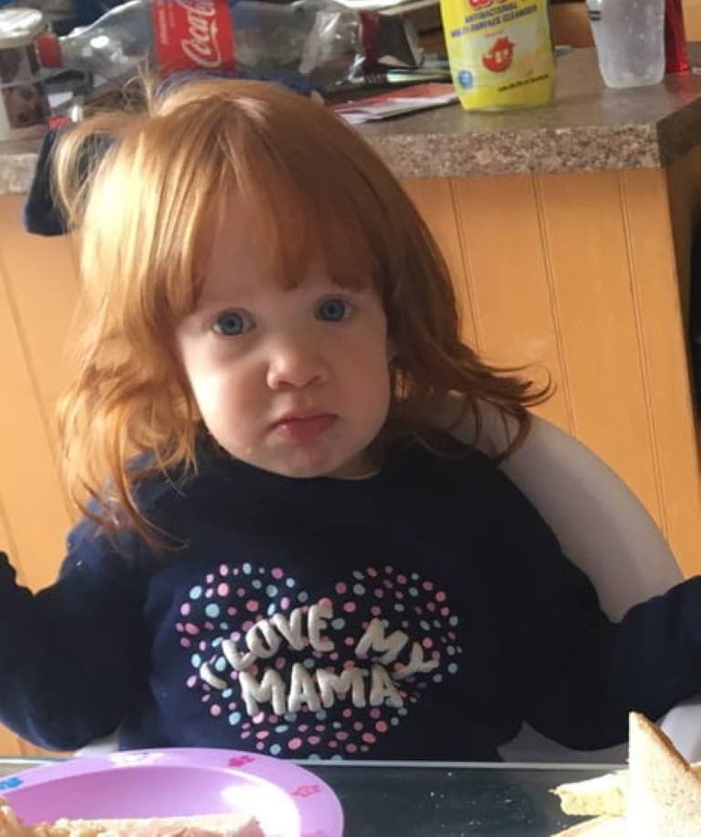 Cuando la madre de esta bebé vio su cabello rompió en llanto y se enojó