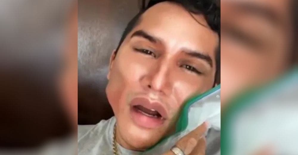 El cantante Edwin Luna alarma a sus fans mostrando el resultado de una cirugía en su rostro
