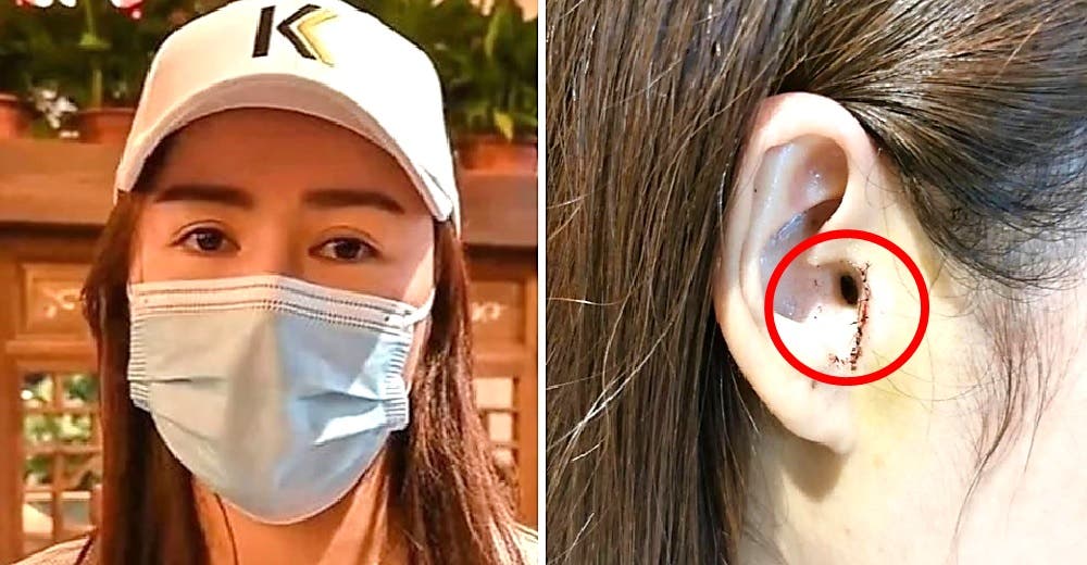 Tras una cirugía reclama indignada que le quitaron una parte de su oreja sin su consentimiento