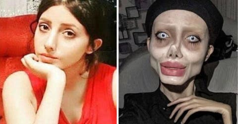 Condenan a 10 años de cárcel a la joven que modificó su rostro para parecerse a Angelina Jolie
