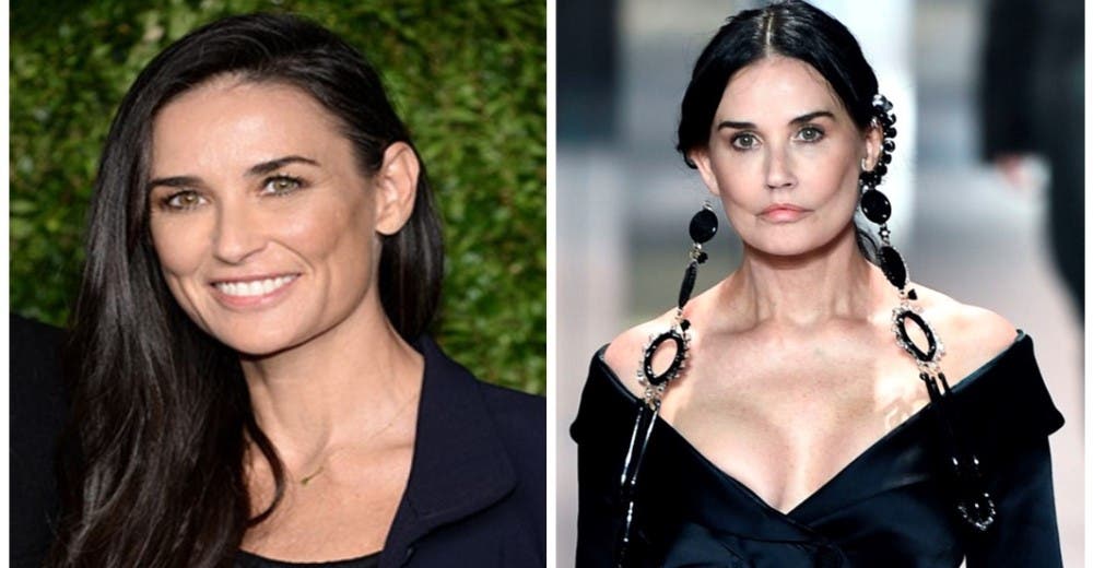 Demi Moore aparece irreconocible por sus desacertados estiramientos faciales Demi Moore aparece irreconocible por sus desacertados estiramientos faciales