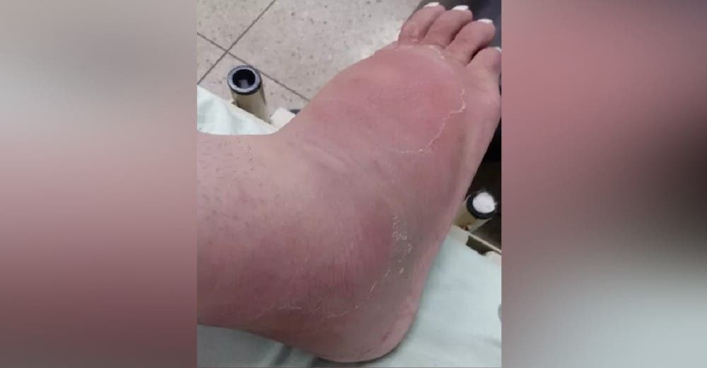 «Nadie hace nada» – Suplica ayuda para evitar perder sus pies a causa de un tratamiento estético «Nadie hace nada» – Suplica ayuda para evitar perder sus pies a causa de un tratamiento estético