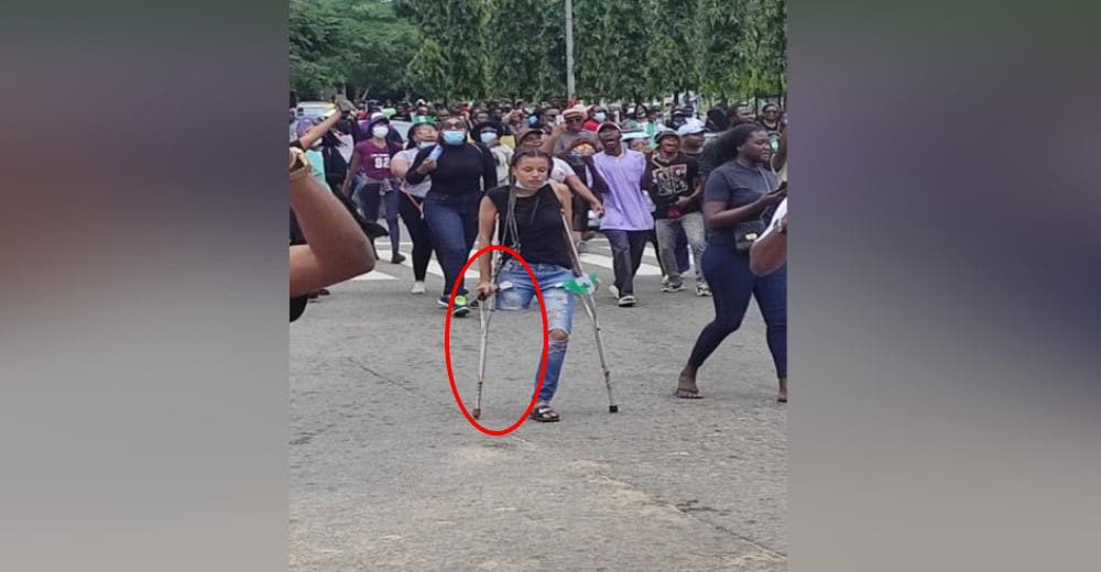 Ayudan a la mujer con una pierna que emocionó al país tras salir a la calle a pedir justicia