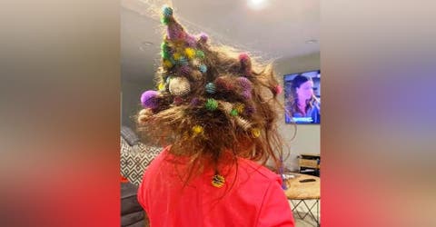 Una angustiada madre difunde su reclamo por los 150 juguetes atascados en el cabello de su hija