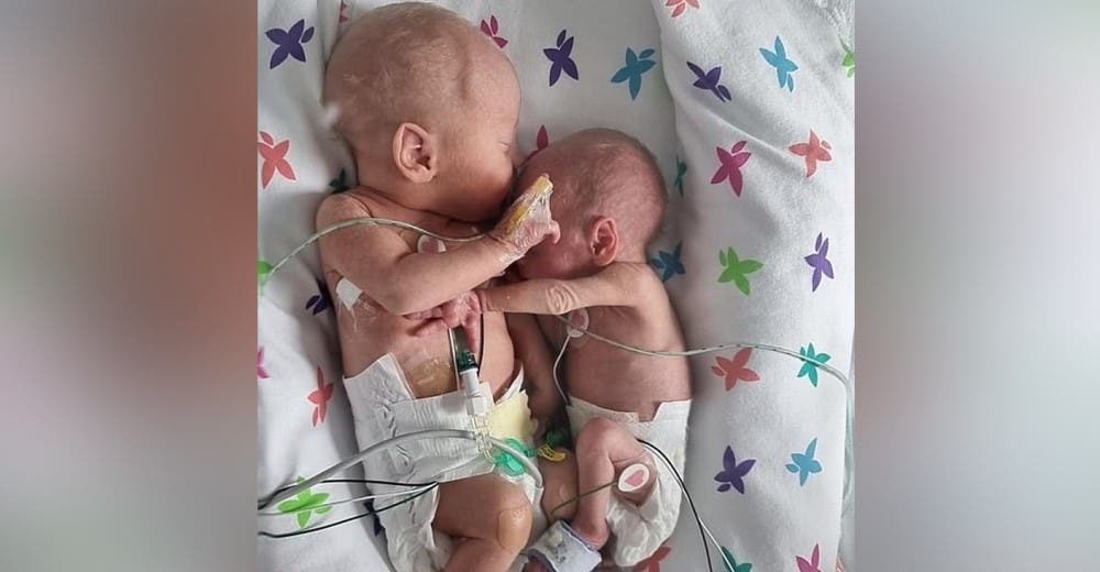 Una bebé prematura que los médicos dijeron que no sobreviviría abraza a su hermanito