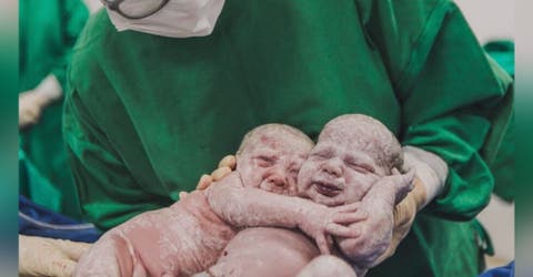 Una bebé abraza a su hermana gemela celebrando el milagro de su nacimiento