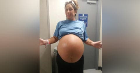 La madre con el vientre gigante da a luz a la niña más grande que los médicos han visto