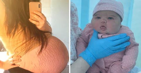 Da a luz a una bebé de casi 6 kilos después de que los médicos pensaran que tendría gemelos