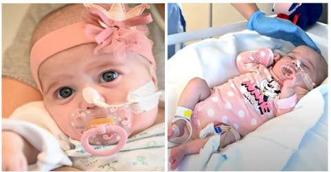 Es la primera bebé en el mundo en recibir un trasplante de corazón de un donante incompatible