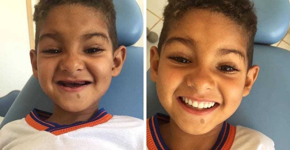 Un humilde niño de 6 años recibe la ayuda que necesitaba para volver a sonreír como antes Un humilde niño de 6 años recibe la ayuda que necesitaba para volver a sonreír como antes