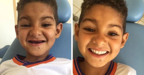 Un humilde niño de 6 años recibe la ayuda que necesitaba para volver a sonreír como antes