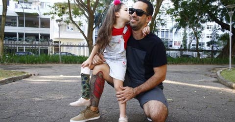 Se tatúa una prótesis para apoyar a su hija de 5 años que perdió una pierna