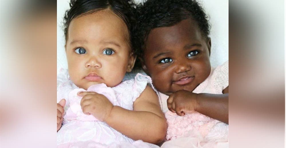 Las gemelas «diferentes» que enamoraron al mundo ya han cumplido 5 años