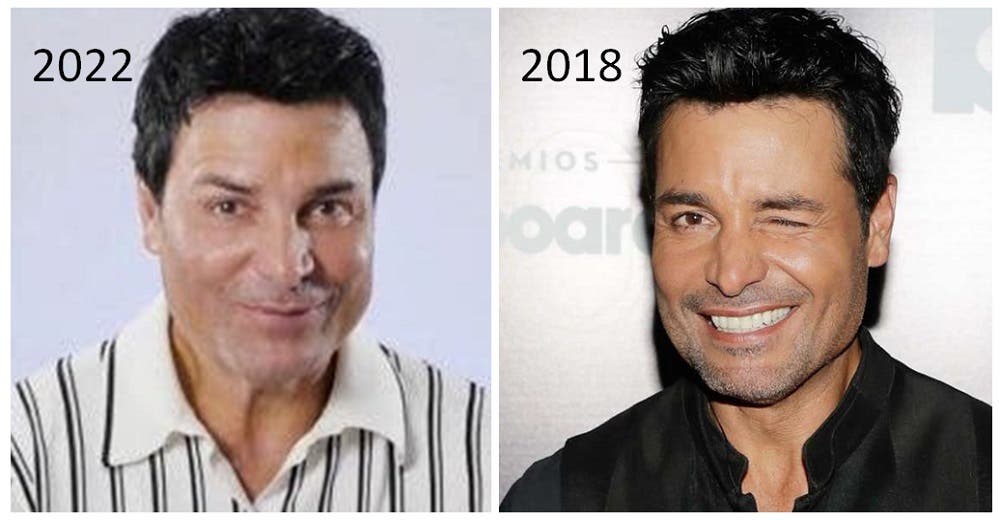 Chayanne presume nuevo rostro y critican los «arreglitos» que se hizo: «Papi, ¿Qué te pasó?» Chayanne presume nuevo rostro y critican los «arreglitos» que se hizo: «Papi, ¿Qué te pasó?»