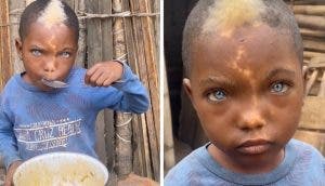 Niño africano cautiva por sus hermosos ojos azules y su marca en forma de rayo