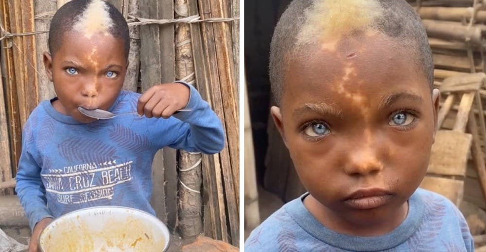 Niño africano cautiva por sus hermosos ojos azules y su marca en forma de rayo