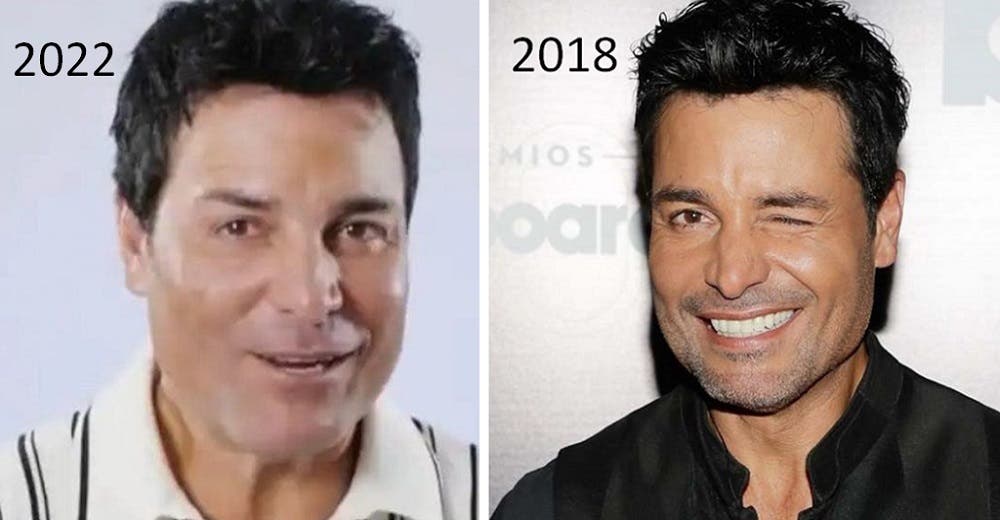 Chayanne presume nuevo rostro y critican sus «arreglitos»: «Papi, ¿Qué te pasó en el rostro?» Chayanne presume nuevo rostro y critican sus «arreglitos»: «Papi, ¿Qué te pasó en el rostro?»