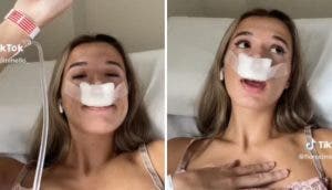 «Me hice la rinoplastia, así mis hijos podrán heredar una nariz linda”