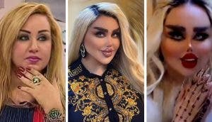 Joven se realiza 43 cirugías para convertirse en una Barbie humana pero la llaman “zombi”